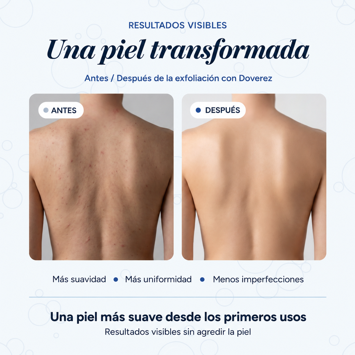 Toalla de ducha exfoliante Doverez