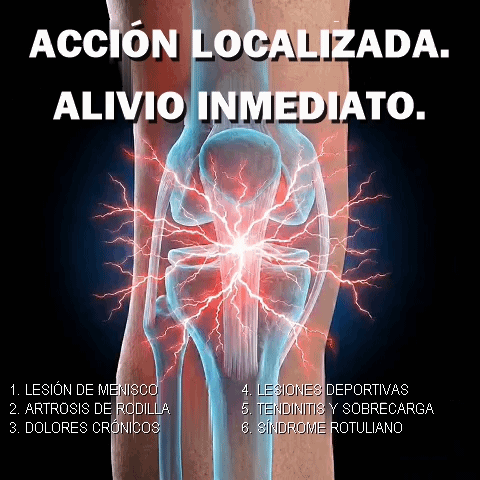 Banda rotuliana - Doverez