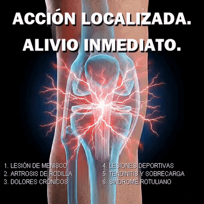 Banda rotuliana - Doverez